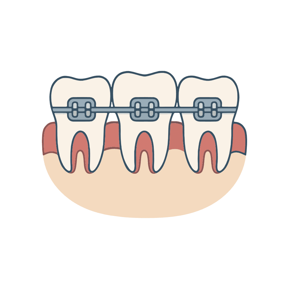 Imagem Ilustração Aparelho