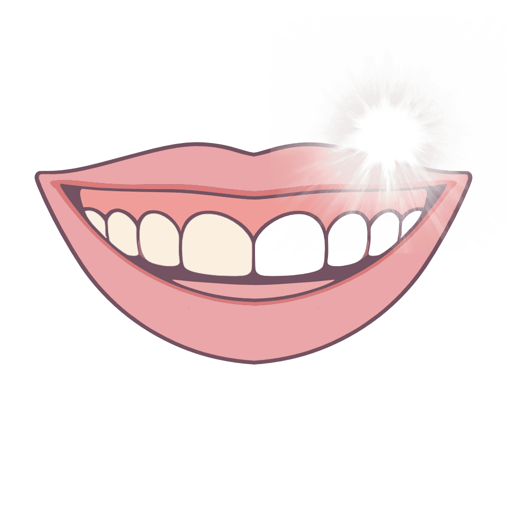 Imagem Ilustração Clareamento