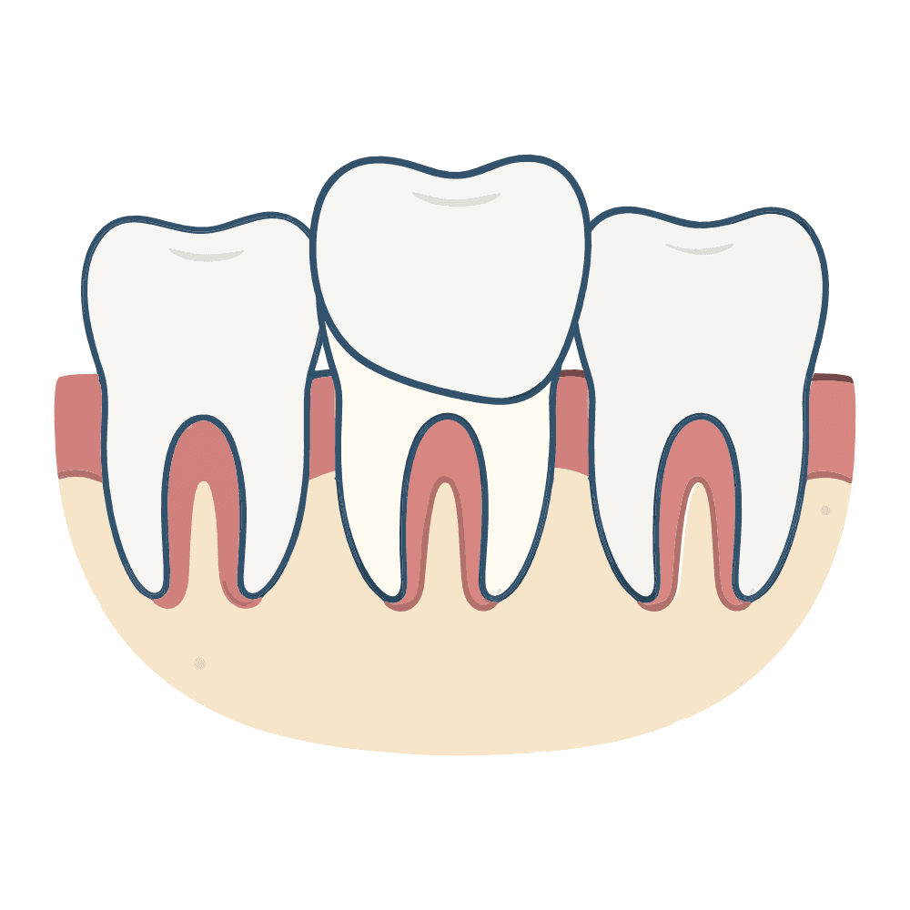 Imagem Ilustração Lentes