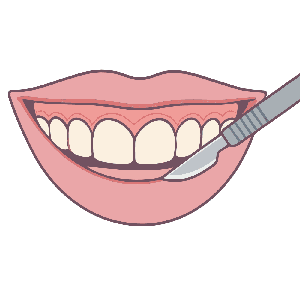 Imagem Ilustração Plastica