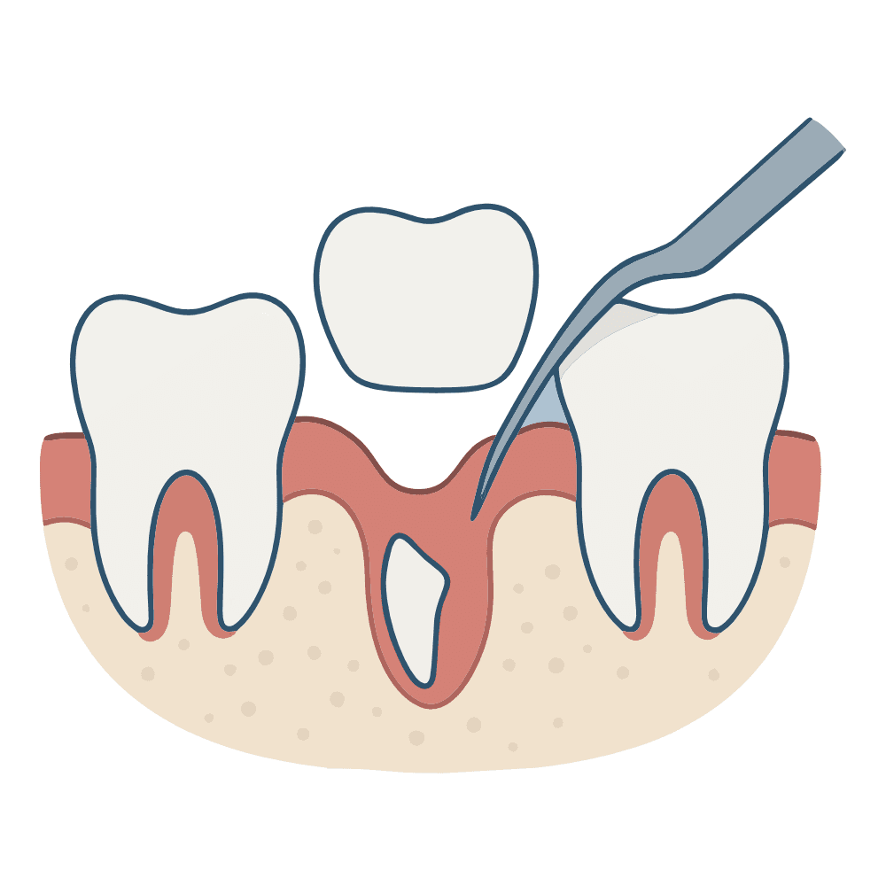 Imagem Ilustração Siso